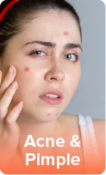 Acne & Pimple